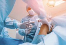 Understanding the Arthroscopy Surgical System Before You Buy