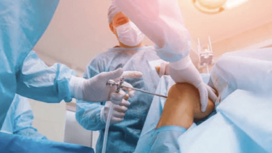 Understanding the Arthroscopy Surgical System Before You Buy