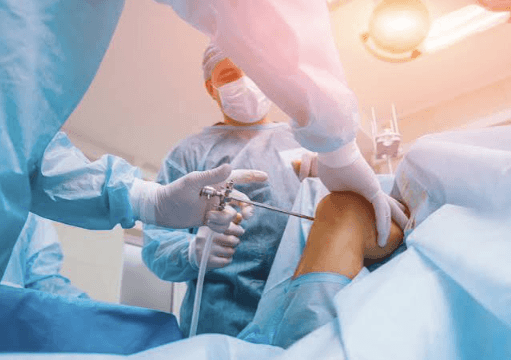 Understanding the Arthroscopy Surgical System Before You Buy